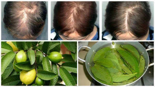 Guava Leaves For Hair
