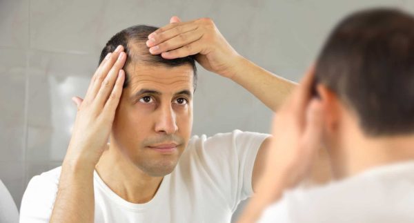 Hair Loss Causes